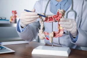 Gastroenterologist,Showing,Human,Colon,Model,At,Table,In,Clinic,,Closeup